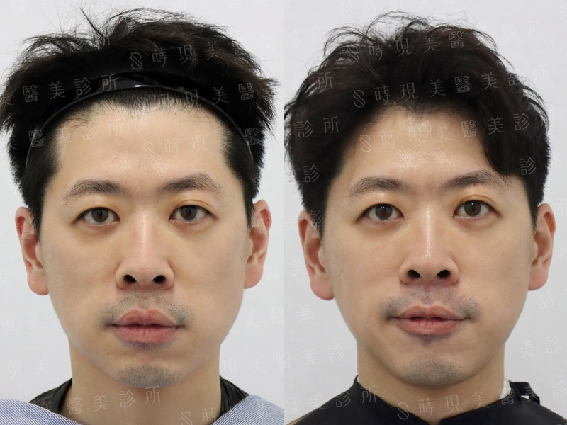 鳳凰電波＋音波